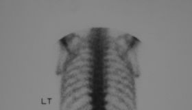 bon scan
