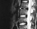 mri 