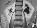 mri.