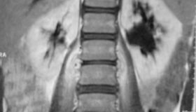 mri.